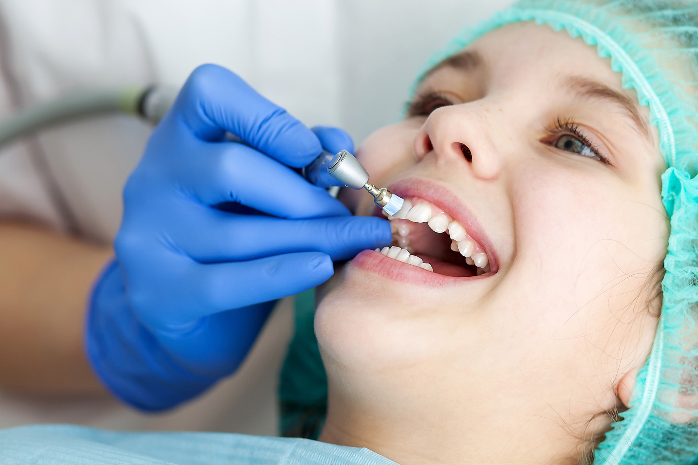 Girl getting dental fluoride applied to her teeth in El Cajon, CA