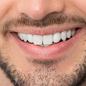 close up of white straight teeth after dental appointment at midway dental group