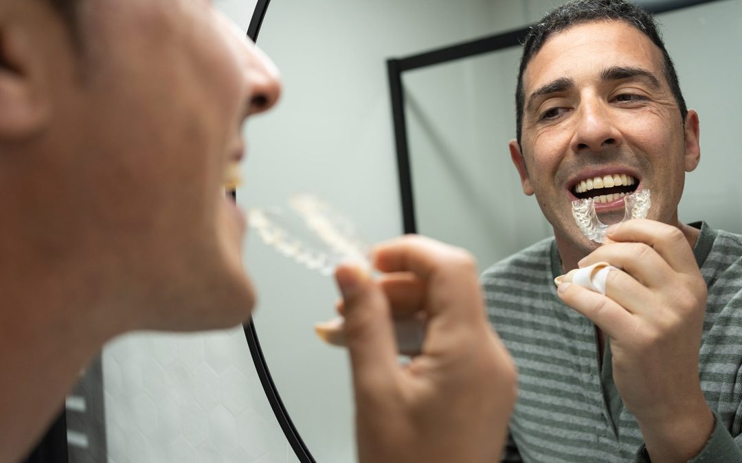 Protecting Your Smile with Mouth Guards in El Cajon, CA