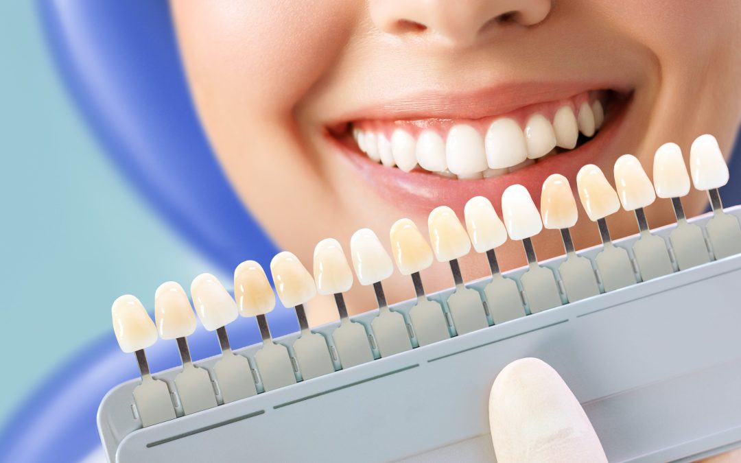 Popular Cosmetic Dentistry Treatments and Their Benefits in El Cajon, CA